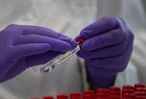 PGIMER doctors have been given the go-ahead to retest patients suspected to have been reinfected with Covid-19.(AP) PGIMER doctors have been given the go-ahead to retest patients suspected to have been reinfected with Covid-19.(AP)