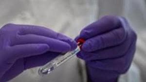 Chief medical officer (CMO) Dr Deepak Ohri said “massive Covid-19 testing” will begin in the district from Wednesday.(AP) Chief medical officer (CMO) Dr Deepak Ohri said “massive Covid-19 testing” will begin in the district from Wednesday.(AP)