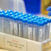 PGIMER has been chosen as a validation centre as part of an Indian Council of Medical and Research (ICMR) programme for clinical trials for such tests for Covid-19 cases.(REUTERS/For representation) PGIMER has been chosen as a validation centre as part of an Indian Council of Medical and Research (ICMR) programme for clinical trials for such tests for Covid-19 cases.(REUTERS/For representation)