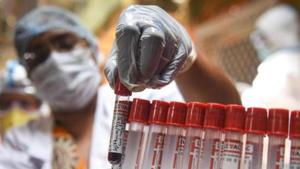 A medical professional places a tube containing a blood sample to test for coronavirus infection at Ram Nagar, in Paharganj, New Delhi on Saturday.(Sanchit Khanna/HT PHOTO) A medical professional places a tube containing a blood sample to test for coronavirus infection at Ram Nagar, in Paharganj, New Delhi on Saturday.(Sanchit Khanna/HT PHOTO)