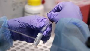 James Robson, a biomedical engineering graduate student, holds a swab and specimen vial in the new COVID-19, on-campus testing lab.(AP) James Robson, a biomedical engineering graduate student, holds a swab and specimen vial in the new COVID-19, on-campus testing lab.(AP)