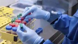 The company plans to take up the question of one or two doses in its phase 1 trial.(AP file photo) The company plans to take up the question of one or two doses in its phase 1 trial.(AP file photo)