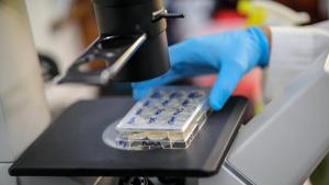A scientist holds cells that produce antibodies against the coronavirus disease.(REUTERS) A scientist holds cells that produce antibodies against the coronavirus disease.(REUTERS)