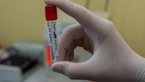 The still-evolving clinical picture, dearth of patient follow-up, and incomplete data on the number of people afflicted by Covid-19 make it difficult to predict the pandemic’s long-term health and economic consequences. (Representational Image)(Unsplash) The still-evolving clinical picture, dearth of patient follow-up, and incomplete data on the number of people afflicted by Covid-19 make it difficult to predict the pandemic’s long-term health and economic consequences. (Representational Image)(Unsplash)