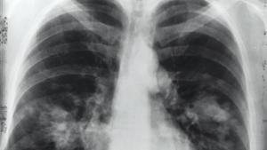 Since X-rays penetrate deep into tissue, they said scientists can use the method to understand the relation between the microscopic tissue structure and the larger function of an organ. (Representational Image)(Unsplash) Since X-rays penetrate deep into tissue, they said scientists can use the method to understand the relation between the microscopic tissue structure and the larger function of an organ. (Representational Image)(Unsplash)
