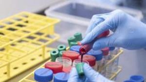 SII is the world’s largest vaccine manufacturer by the number of doses produced and sold globally. (Image for representational purpose only).(AP) SII is the world’s largest vaccine manufacturer by the number of doses produced and sold globally. (Image for representational purpose only).(AP)