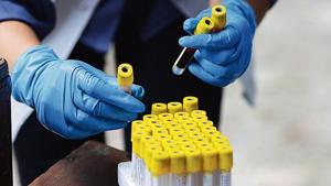 Results have been released from 20 rounds of seroprevalence studies that have been conducted across the country by state governments to calculate the spread of Sars-CoV-2 — the virus that causes Covid-19.(Bloomberg file photo) Results have been released from 20 rounds of seroprevalence studies that have been conducted across the country by state governments to calculate the spread of Sars-CoV-2 — the virus that causes Covid-19.(Bloomberg file photo)