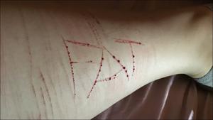 Here’s how you can identify adolescents at risk of self-harm(Twitter/s3lfh4rming) Here’s how you can identify adolescents at risk of self-harm(Twitter/s3lfh4rming)