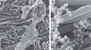 An en face image (Panel A) shows an infected ciliated cell with strands of mucus attached to the cilia tips. At higher magnification, an image (Panel B) shows the structure and density of SARS-CoV-2 virions produced by human airway epithelial cells.(Photo courtesy: New England Journal of Medicine) An en face image (Panel A) shows an infected ciliated cell with strands of mucus attached to the cilia tips. At higher magnification, an image (Panel B) shows the structure and density of SARS-CoV-2 virions produced by human airway epithelial cells.(Photo courtesy: New England Journal of Medicine)