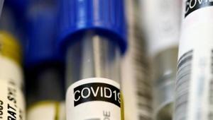 Sikkim reported 28 deaths and 2,391 Covid-19 cases till Saturday night.(ANI) Sikkim reported 28 deaths and 2,391 Covid-19 cases till Saturday night.(ANI)