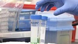 RT-PCR is now considered the gold standard for diagnosis of the coronavirus disease.(AP) RT-PCR is now considered the gold standard for diagnosis of the coronavirus disease.(AP)