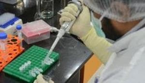 Without early doses that can bring outbreaks under control, many of these countries risk economic collapse that will push hundreds of millions of people back into poverty.(REUTERS) Without early doses that can bring outbreaks under control, many of these countries risk economic collapse that will push hundreds of millions of people back into poverty.(REUTERS)