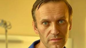 Navalny, a politician and corruption investigator who is Putin’s fiercest critic, was flown to Germany two days after falling ill on Aug. 20 on a domestic flight in Russia.(via Reuters) Navalny, a politician and corruption investigator who is Putin’s fiercest critic, was flown to Germany two days after falling ill on Aug. 20 on a domestic flight in Russia.(via Reuters)