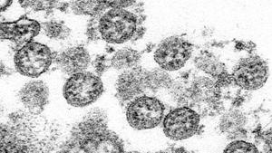 The woman was infected with Covid-19 in the beginning this year and developed severe cough and fever. She was discharged from the hospital after she was cured. It was almost two months later during the second day of her chemotherapy treatment it was found out that she had the coronavirus, again.(AP) The woman was infected with Covid-19 in the beginning this year and developed severe cough and fever. She was discharged from the hospital after she was cured. It was almost two months later during the second day of her chemotherapy treatment it was found out that she had the coronavirus, again.(AP)
