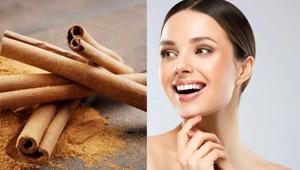 Cinnamon = glowing skin.(Shutterstock) Cinnamon = glowing skin.(Shutterstock)
