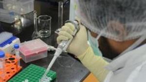 The study was conducted by researchers at Dental College of Georgia and Medical College of Georgia (MCG).(REUTERS) The study was conducted by researchers at Dental College of Georgia and Medical College of Georgia (MCG).(REUTERS)
