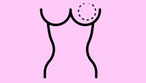 The link between diabetes and breast cancer.(Kantor Tegalsari from the Noun Project (via Creative Commons)) The link between diabetes and breast cancer.(Kantor Tegalsari from the Noun Project (via Creative Commons))
