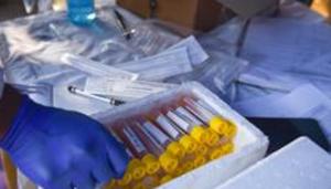 The researchers detailed how the inflammatory cell death signaling pathway worked, which led to potential therapies to disrupt the process.(Sanchit Khanna/HT PHOTO)