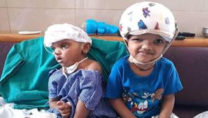 After the post-operative rehabilitation and care in AIIMS New Delhi for almost 2 years, the twins returned to Odisha in September last year, but did not go back to their home in Kandhamal and remained at SCB Medical College under the supervision of a team of doctors.(HT PHOTO.) After the post-operative rehabilitation and care in AIIMS New Delhi for almost 2 years, the twins returned to Odisha in September last year, but did not go back to their home in Kandhamal and remained at SCB Medical College under the supervision of a team of doctors.(HT PHOTO.)