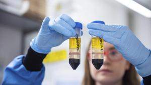 A researcher in a laboratory at the Jenner Institute in Oxford, England, works on the coronavirus vaccine developed by AstraZeneca and Oxford University.(AP File Photo) A researcher in a laboratory at the Jenner Institute in Oxford, England, works on the coronavirus vaccine developed by AstraZeneca and Oxford University.(AP File Photo)