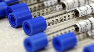 Vials containing banned drugs have been seized from a Chandigarh woman who started a career in crime with petty thefts.(AP/For representational purposes) Vials containing banned drugs have been seized from a Chandigarh woman who started a career in crime with petty thefts.(AP/For representational purposes)