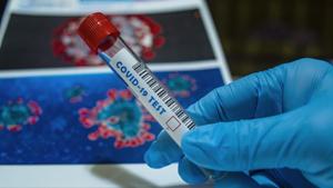 Genome sequencing can help scientists monitor small changes in the virus at a national or international scale to understand how it is spreading and provide insight into how different cases are linked.(Pixabay) Genome sequencing can help scientists monitor small changes in the virus at a national or international scale to understand how it is spreading and provide insight into how different cases are linked.(Pixabay)