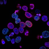 A recent study has found a newly developed compound that starves cancer cells by attacking their “power plants” - the so-called mitochondria.(Unsplash) A recent study has found a newly developed compound that starves cancer cells by attacking their “power plants” - the so-called mitochondria.(Unsplash)