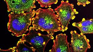 Published in the journal Nature, a study provides new insights into how cancers evolve to adapt to changing environments and suggests ways to reduce drug resistance by combining therapies.(Pixabay) Published in the journal Nature, a study provides new insights into how cancers evolve to adapt to changing environments and suggests ways to reduce drug resistance by combining therapies.(Pixabay)