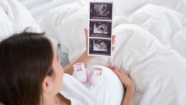 Today the global rate of cases where the baby could not fit through the maternal birth canal have increased from 30 in 1,000 in the 1960s to 36 in 1,000 births. (Shutterstock) Today the global rate of cases where the baby could not fit through the maternal birth canal have increased from 30 in 1,000 in the 1960s to 36 in 1,000 births. (Shutterstock)