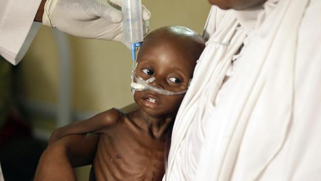 In this August 29, 2016 file photo, a doctor feeds a malnourished child at a feeding centre run by Doctors Without Borders in Maiduguri, Nigeria. The UN children’s agency said on Tuesday, Dec. 13, that nearly a half million children will face starvation in northeast Nigeria next year and 80,000 will die if they don’t get treatment in the humanitarian crisis created by Boko Haram’s Islamic uprising. (AP) In this August 29, 2016 file photo, a doctor feeds a malnourished child at a feeding centre run by Doctors Without Borders in Maiduguri, Nigeria. The UN children’s agency said on Tuesday, Dec. 13, that nearly a half million children will face starvation in northeast Nigeria next year and 80,000 will die if they don’t get treatment in the humanitarian crisis created by Boko Haram’s Islamic uprising. (AP)