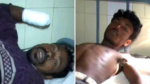 The traffickers chopped off the hands of Nilambar Dhangdamajhi (L) and Dayalu Nial (R) in Odisha state on December 15, 2013. (HT file photo) The traffickers chopped off the hands of Nilambar Dhangdamajhi (L) and Dayalu Nial (R) in Odisha state on December 15, 2013. (HT file photo)