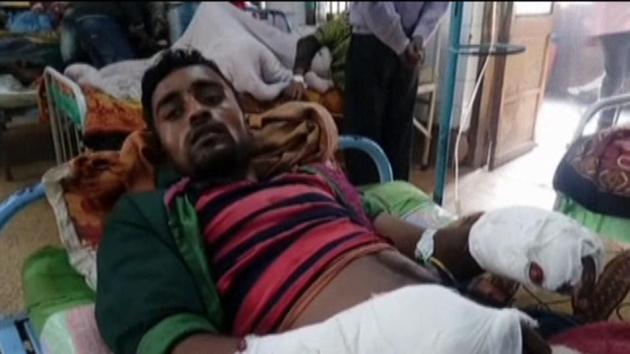 Ganesh Ghosh in a hospital in Malda after the amputation.(HT Photo)