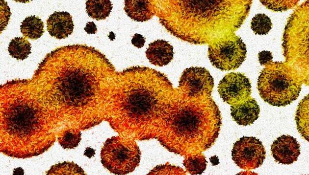 Scientists have developed a new test that can identify harmful bacteria like superbugs within two hours. (Shutterstock) Scientists have developed a new test that can identify harmful bacteria like superbugs within two hours. (Shutterstock)