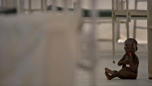 A young child sits on the floor in the therapeutic feeding unit of the medicines Sans Frontieres (Doctors Without Borders) hospital. (AP Photo)