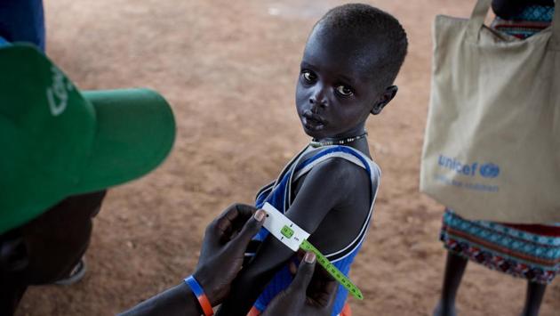 A boy has his arm measured to see if he is suffering from malnutrition during a nutritional assessment at an emergency medical facility supported by UNICEF in Kuach. (AP Photo)