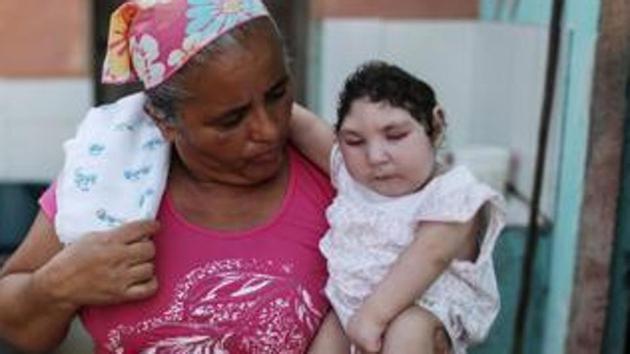 Currently there is no cure or treatment for the virus, which has been linked to serious neurological problems in infants whose mothers were exposed in early pregnancy. (AFP file) Currently there is no cure or treatment for the virus, which has been linked to serious neurological problems in infants whose mothers were exposed in early pregnancy. (AFP file)