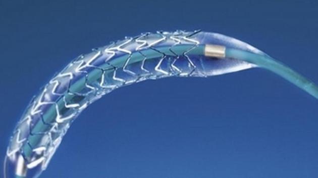 The NPPA has slashed prices of coronary stents by up to 85%, capping them at Rs 7,260 for bare metal ones and Rs 29,600 for the drug eluting variety. (AP Photo) The NPPA has slashed prices of coronary stents by up to 85%, capping them at Rs 7,260 for bare metal ones and Rs 29,600 for the drug eluting variety. (AP Photo)