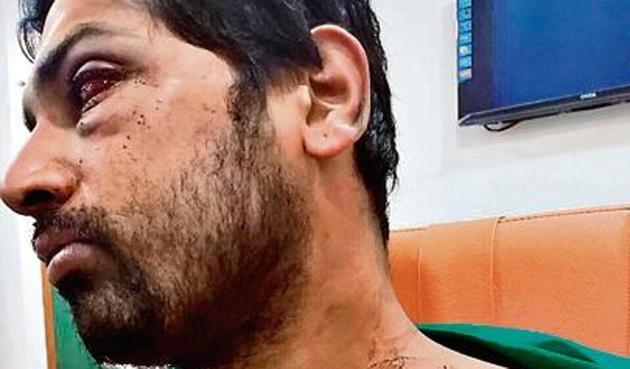 Dr Rohan Mhamunkar, a senior doctor at the Dhule civil Hospital, was assaulted by 15 to 20 relatives of a patient after he requested the family to shift the patient to another hospital owing to unavailability of a neurologist.(HT photo)