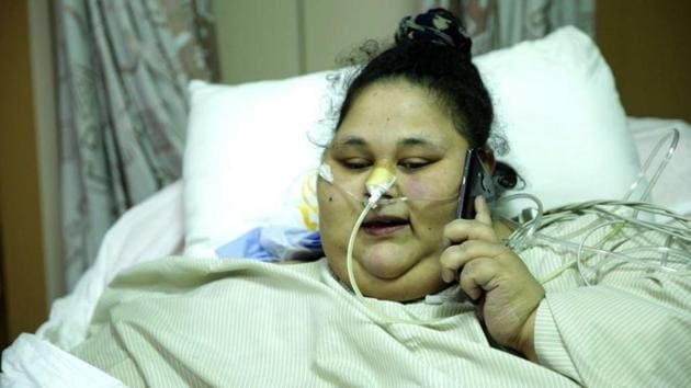 Eman Ahmed underwent a laparoscopic weight-loss procedure called sleeve gastrectomy at Mumbai’s Saifee Hospital on March 7 to reduce the size of her stomach to less than 15% of its original size.