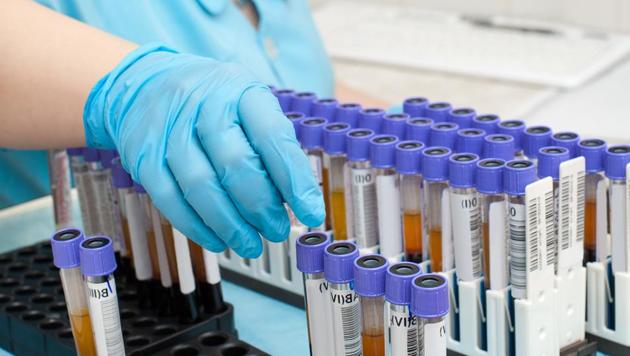 This simple blood test for cancer would be far less invasive than scopes or biopsies.(Shutterstock)