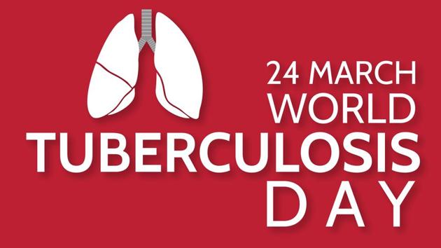 Apart from a cough that lasts two weeks or longer and coughing up mucous or blood, signs of TB include fatigue, weight loss, loss of appetite, low fever and chills and night sweats. (Shutterstock) Apart from a cough that lasts two weeks or longer and coughing up mucous or blood, signs of TB include fatigue, weight loss, loss of appetite, low fever and chills and night sweats. (Shutterstock)