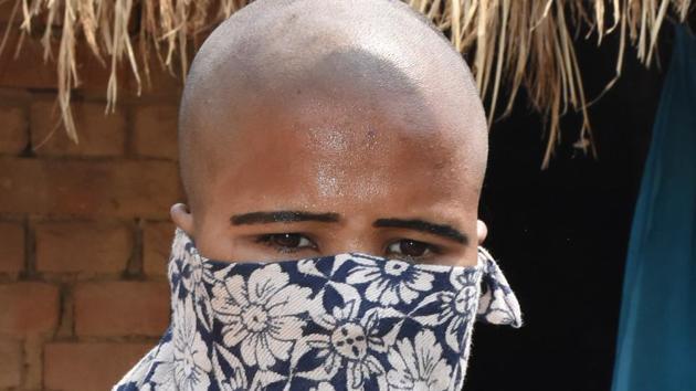 A woman whose head was tonsured over an alleged illicit relationship with a man in Bhagalpur district. (HT photo) A woman whose head was tonsured over an alleged illicit relationship with a man in Bhagalpur district. (HT photo)