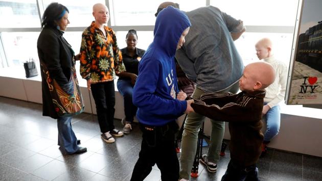 Mwigulu Magesa (front-L) plays with Baraka Lusambo, (R) Tanzanian's with Albinism visiting the U.S. for medical care, after they arrived at JFK International Airport in New York City. Albinism is a congenital disorder affecting about one in 20,000 people worldwide who lack pigment in their skin, hair and eyes. It is more common in sub-Saharan Africa and affects about one Tanzanian in 1,400. (Brendan McDermid/REUTERS) Mwigulu Magesa (front-L) plays with Baraka Lusambo, (R) Tanzanian's with Albinism visiting the U.S. for medical care, after they arrived at JFK International Airport in New York City. Albinism is a congenital disorder affecting about one in 20,000 people worldwide who lack pigment in their skin, hair and eyes. It is more common in sub-Saharan Africa and affects about one Tanzanian in 1,400. (Brendan McDermid/REUTERS)