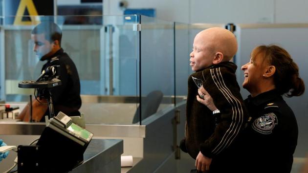 Baraka Lusambo, a Tanzanian with Albinism visiting the U.S. for medical care, is held up by Teresa Piasecka, Supervisory CBP officer for U.S. Customs and Border Protection, as he is cleared at customs following his arrival at JFK International Airport in New York City. The children are expected to stay about two months, getting medical treatment courtesy of the Shriners Hospital in Philadelphia. (Brendan McDermid/REUTERS) Baraka Lusambo, a Tanzanian with Albinism visiting the U.S. for medical care, is held up by Teresa Piasecka, Supervisory CBP officer for U.S. Customs and Border Protection, as he is cleared at customs following his arrival at JFK International Airport in New York City. The children are expected to stay about two months, getting medical treatment courtesy of the Shriners Hospital in Philadelphia. (Brendan McDermid/REUTERS)