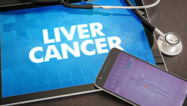 Exposure to a fungal product called aflatoxin is believed to cause up to 80% of liver cancer cases across the world. (Images: Shutterstock) Exposure to a fungal product called aflatoxin is believed to cause up to 80% of liver cancer cases across the world. (Images: Shutterstock)