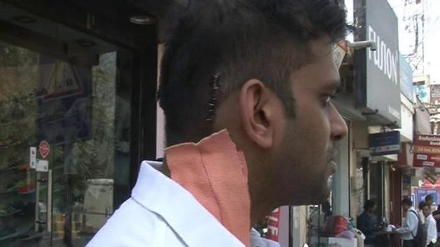 One of youths, who were assaulted at the Gurgaon pub on Monday night. (HT Photo) One of youths, who were assaulted at the Gurgaon pub on Monday night. (HT Photo)