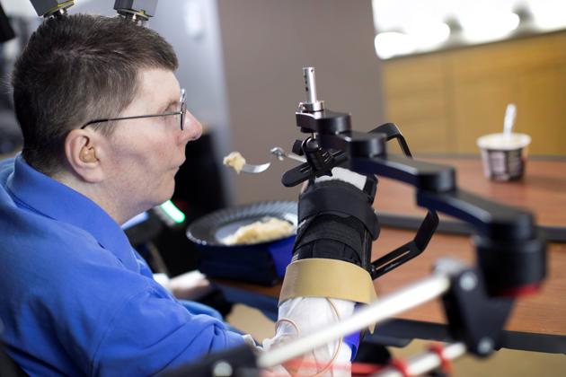 Bill Kochevar is using computer-brain interface technology and an electrical stimulation system to move his own arm after eight years of paralysis. (REUTERS) Bill Kochevar is using computer-brain interface technology and an electrical stimulation system to move his own arm after eight years of paralysis. (REUTERS)