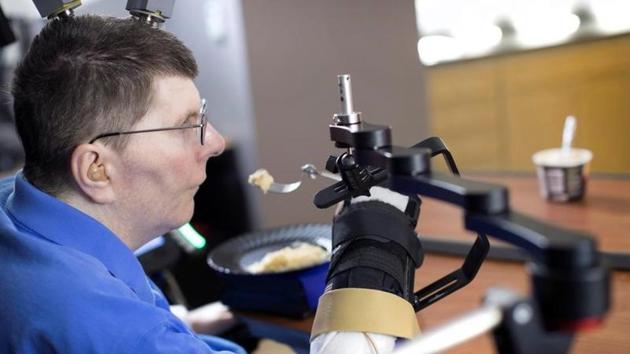 Bill Kochevar, 56, is using computer-brain interface technology and an electrical stimulation system to move his own arm after eight years of paralysis.(Reuters Photo)