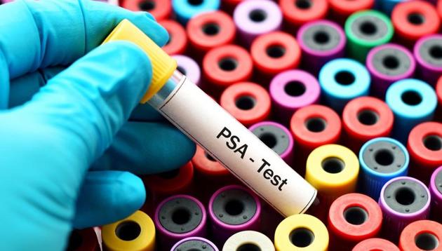 The researchers said their test could become available to patients and doctors within the next few years. (Shutterstock) The researchers said their test could become available to patients and doctors within the next few years. (Shutterstock)