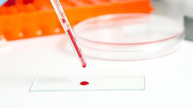The new tests monitor levels of DNA fragments in the blood that are released when tumour cells die and split.(Shutterstock)